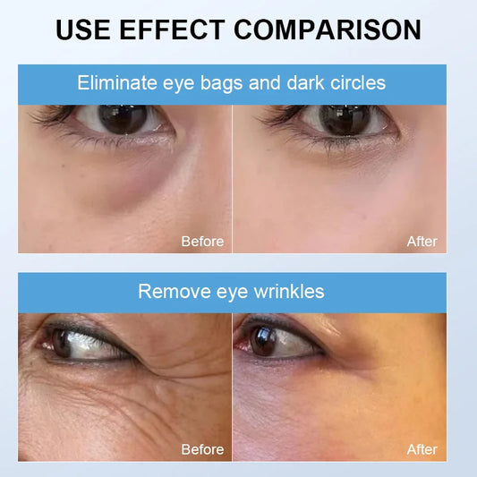 TRC | Anti-Aging Removal Dark Circles | Linavd